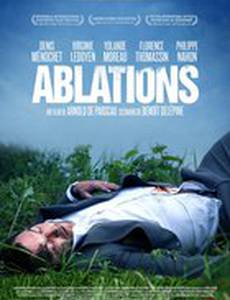 Ablations