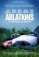 Ablations